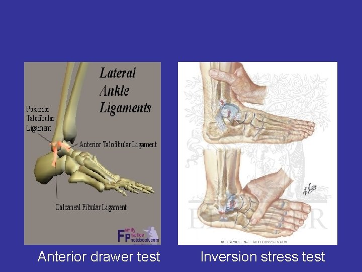 Anterior drawer test Inversion stress test 