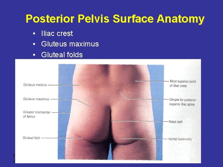 Posterior Pelvis Surface Anatomy • • • Iliac crest Gluteus maximus Gluteal folds Frolich,