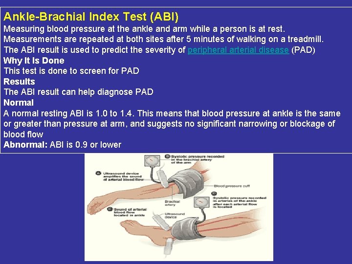 Ankle-Brachial Index Test (ABI) Measuring blood pressure at the ankle and arm while a