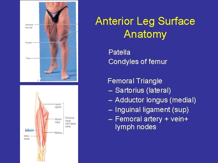 Anterior Leg Surface Anatomy Patella Condyles of femur Femoral Triangle – Sartorius (lateral) –
