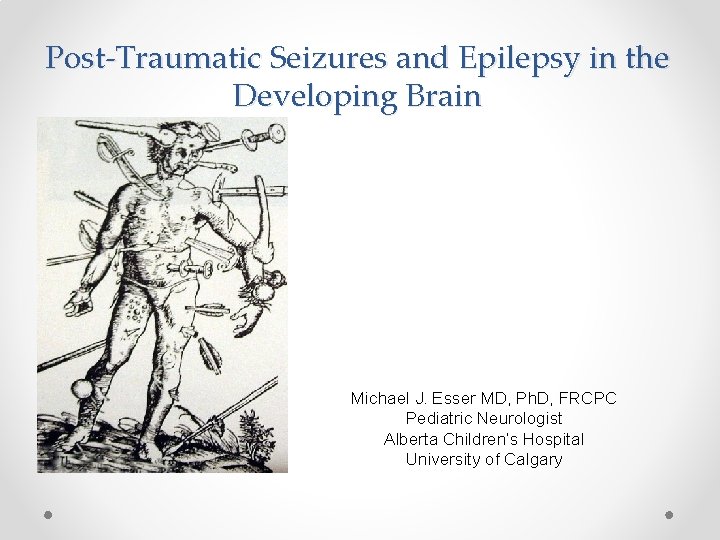 Post-Traumatic Seizures and Epilepsy in the Developing Brain Michael J. Esser MD, Ph. D,