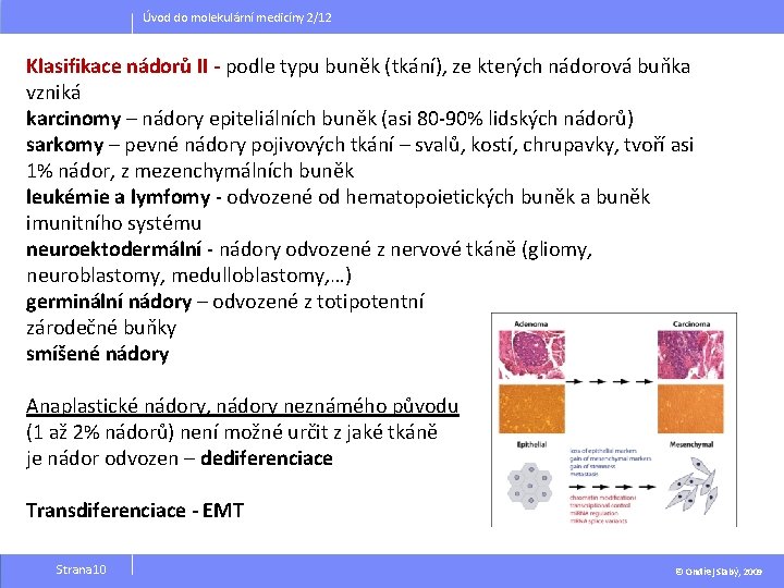 Úvod do molekulární medicíny 2/12 Klasifikace nádorů II - podle typu buněk (tkání), ze