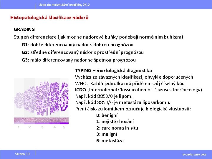 Úvod do molekulární medicíny 2/12 Histopatologická klasifikace nádorů GRADING Stupeň diferenciace (jak moc se