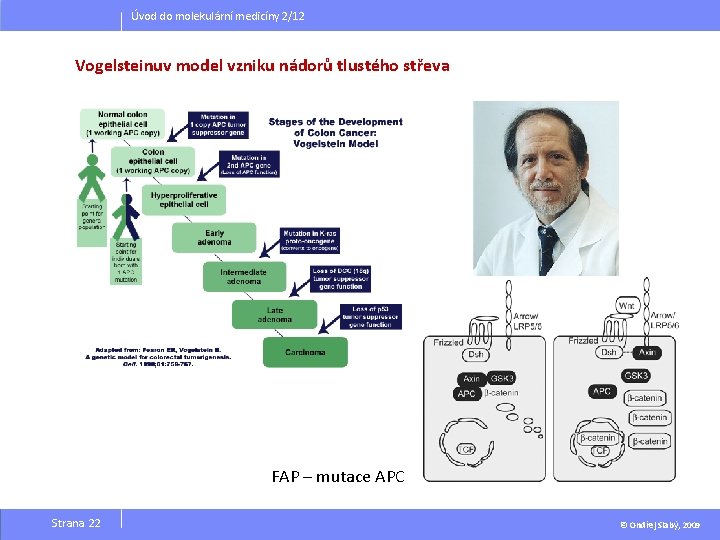 Úvod do molekulární medicíny 2/12 Vogelsteinuv model vzniku nádorů tlustého střeva FAP – mutace