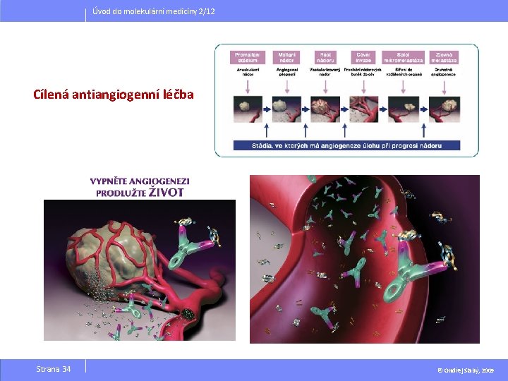 Úvod do molekulární medicíny 2/12 Cílená antiangiogenní léčba Strana 34 © Ondřej Slabý, 2009