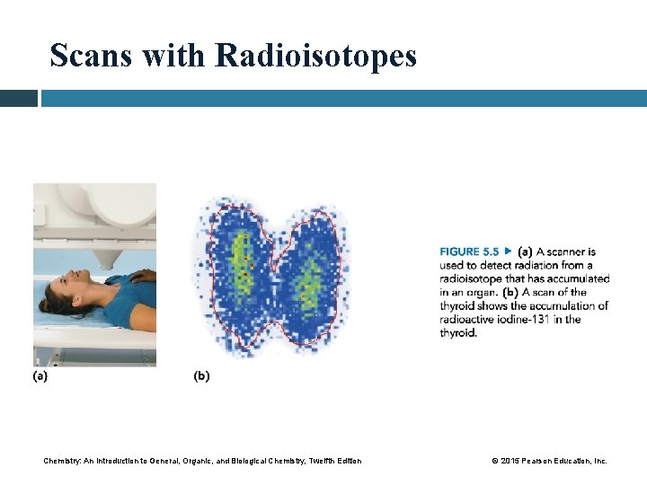 Scans with Radioisotopes Chemistry: An Introduction to General, Organic, and Biological Chemistry, Twelfth Edition