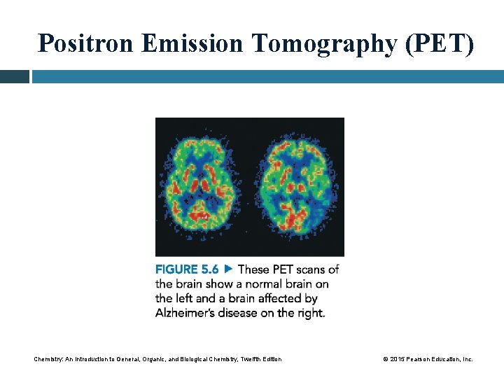 Positron Emission Tomography (PET) Chemistry: An Introduction to General, Organic, and Biological Chemistry, Twelfth