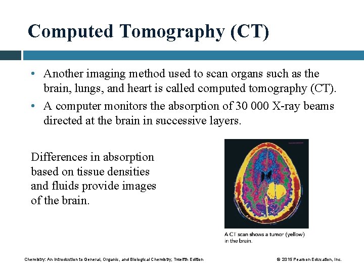 Computed Tomography (CT) • Another imaging method used to scan organs such as the