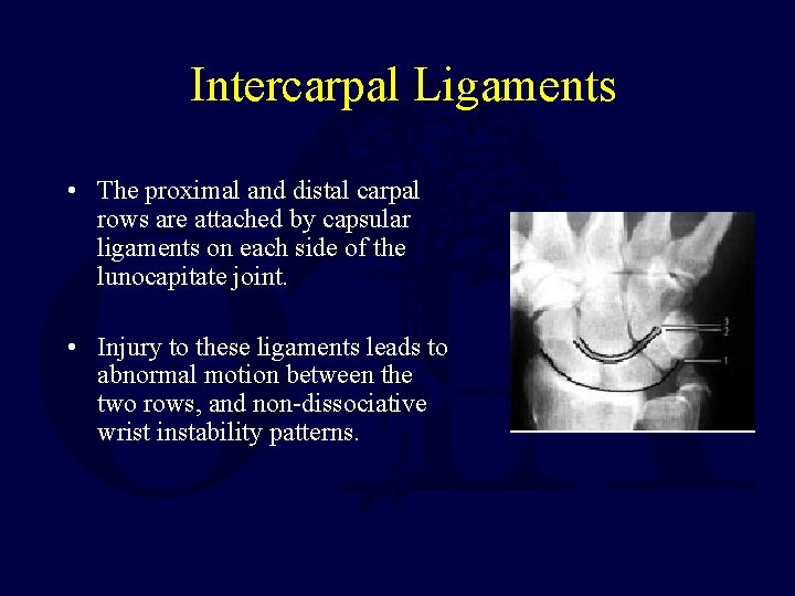 Intercarpal Ligaments • The proximal and distal carpal rows are attached by capsular ligaments