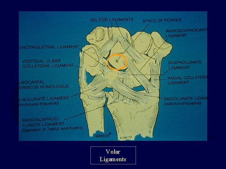 Volar Ligaments 