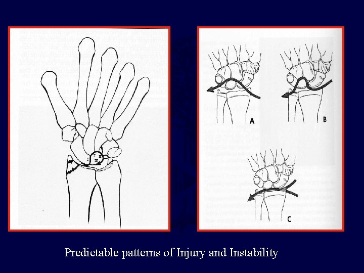 Predictable patterns of Injury and Instability 