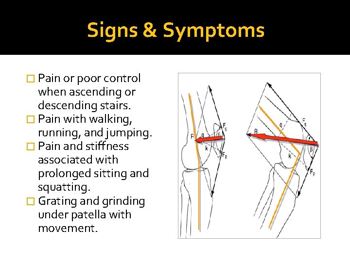 Signs & Symptoms � Pain or poor control when ascending or descending stairs. �