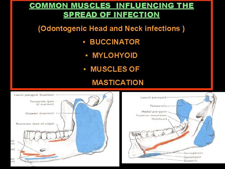 COMMON MUSCLES INFLUENCING THE SPREAD OF INFECTION (Odontogenic Head and Neck infections ) •