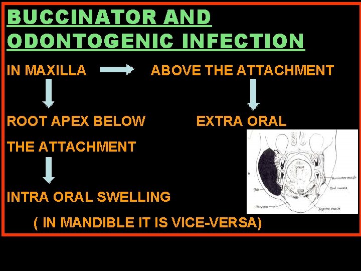 BUCCINATOR AND ODONTOGENIC INFECTION IN MAXILLA ABOVE THE ATTACHMENT ROOT APEX BELOW EXTRA ORAL