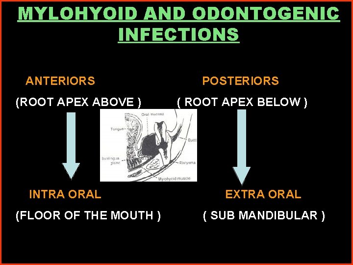MYLOHYOID AND ODONTOGENIC INFECTIONS ANTERIORS (ROOT APEX ABOVE ) POSTERIORS ( ROOT APEX BELOW