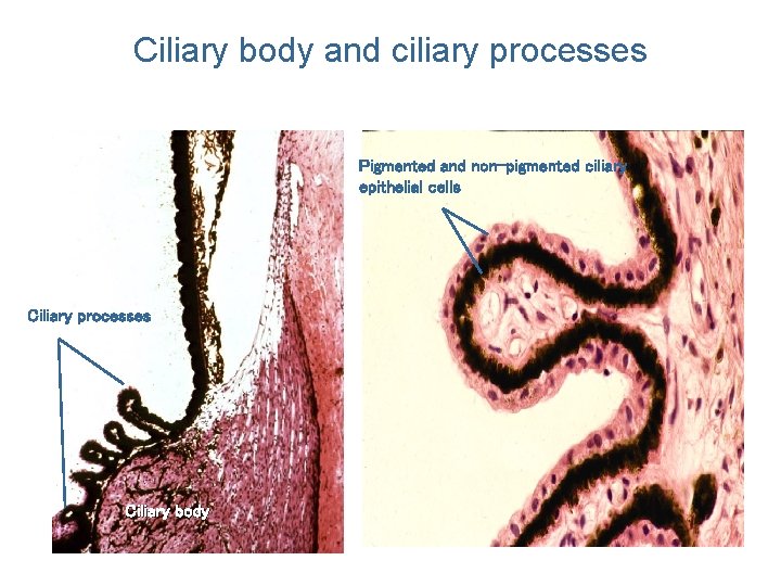 Ciliary body and ciliary processes Pigmented and non-pigmented ciliary epithelial cells Ciliary processes Ciliary