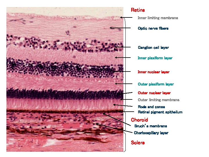 Retina Inner limiting membrane Optic nerve fibers Ganglion cell layer Inner plexiform layer Inner