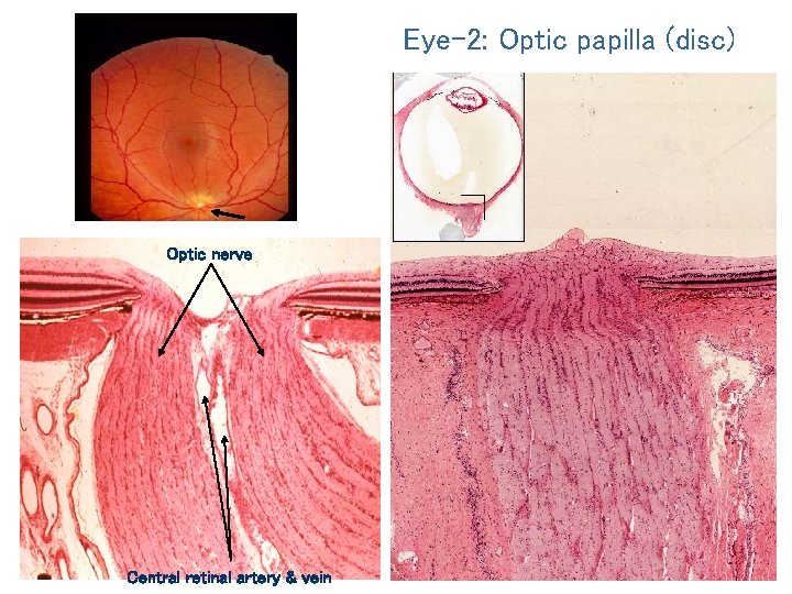 Eye-2: Optic papilla (disc) Optic nerve Central retinal artery & vein 