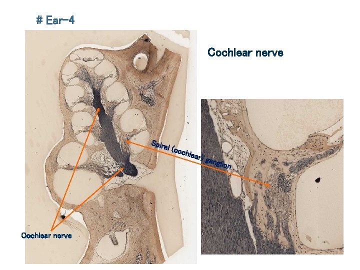 # Ear-4 Cochlear nerve Spira l (co Cochlear nerve chlea r) ga n glion