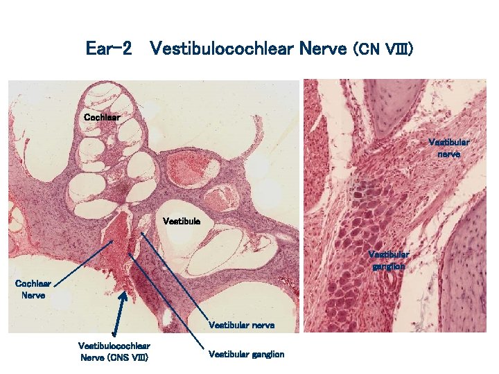 Ear-2 Vestibulocochlear Nerve (CN VIII) Cochlear Vestibular nerve Vestibular ganglion Cochlear Nerve Vestibular nerve