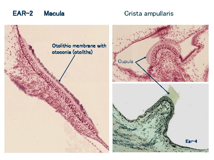 EAR-2 Macula Crista ampullaris Otolithic membrane with otoconia (otoliths) Cupula Ear-4 