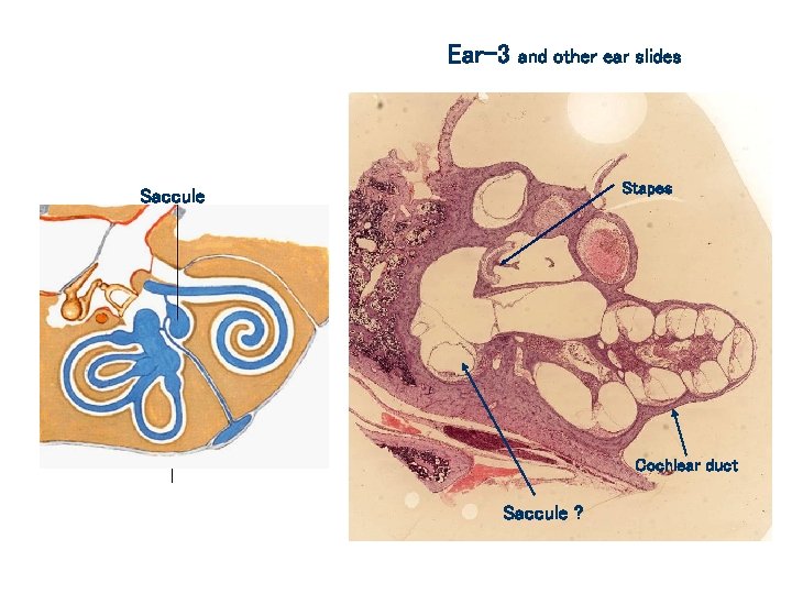 Ear-3 and other ear slides Stapes Saccule Cochlear duct Saccule ? 