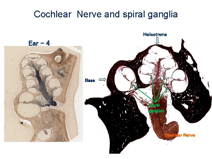 Cochlear Nerve and spiral ganglia Helicotrema Ear - 4 Base Spiral ganglion Cochlear Nerve