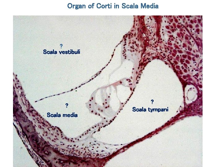 Organ of Corti in Scala Media ? Scala vestibuli ? Scala media ? Scala