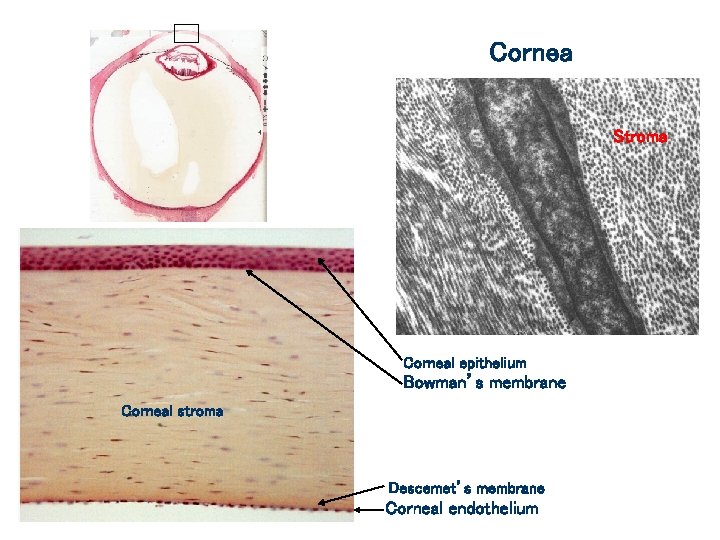 Cornea Stroma Corneal epithelium Bowman’s membrane Corneal stroma Descemet’s membrane Corneal endothelium 