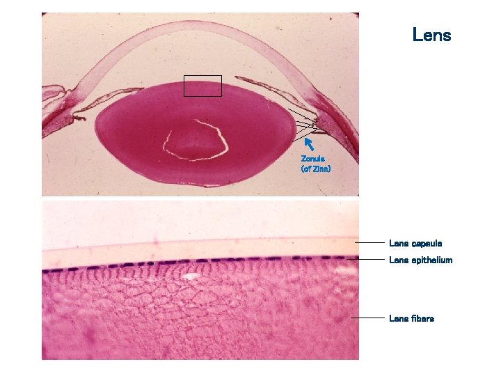 Lens Zonule (of Zinn) Lens capsule Lens epithelium Lens fibers 