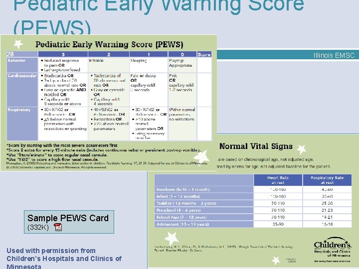 Pediatric Early Warning Score (PEWS) 28 Illinois EMSC Sample PEWS Card (332 K) Used