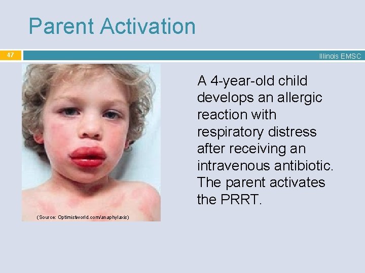 Parent Activation 47 Illinois EMSC A 4 -year-old child develops an allergic reaction with