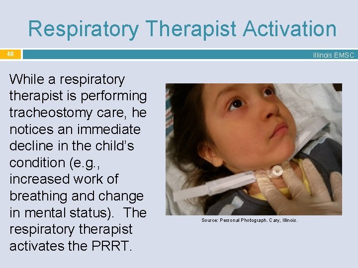 Respiratory Therapist Activation 48 While a respiratory therapist is performing tracheostomy care, he notices