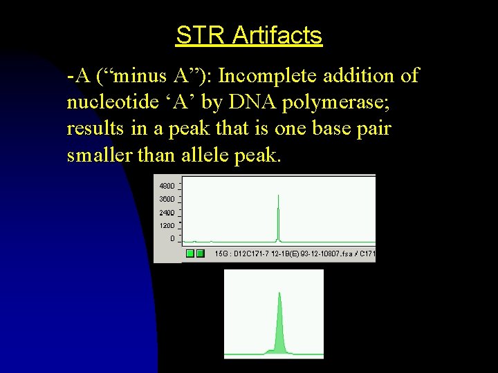 STR Artifacts -A (“minus A”): Incomplete addition of nucleotide ‘A’ by DNA polymerase; results