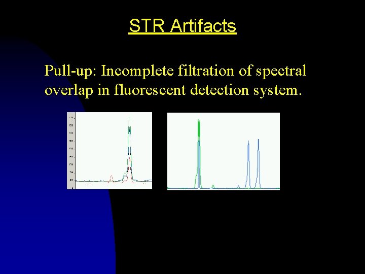 STR Artifacts Pull-up: Incomplete filtration of spectral overlap in fluorescent detection system. 