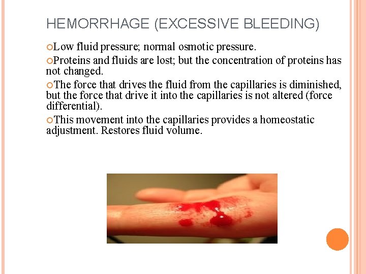 HEMORRHAGE (EXCESSIVE BLEEDING) Low fluid pressure; normal osmotic pressure. Proteins and fluids are lost;
