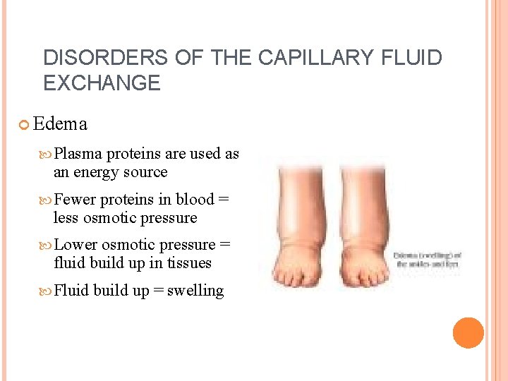 DISORDERS OF THE CAPILLARY FLUID EXCHANGE Edema Plasma proteins are used as an energy