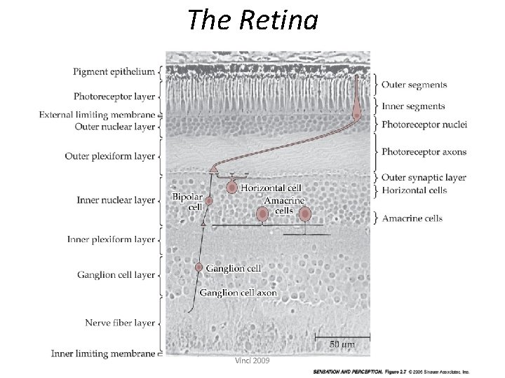 The Retina Vinci 2009 