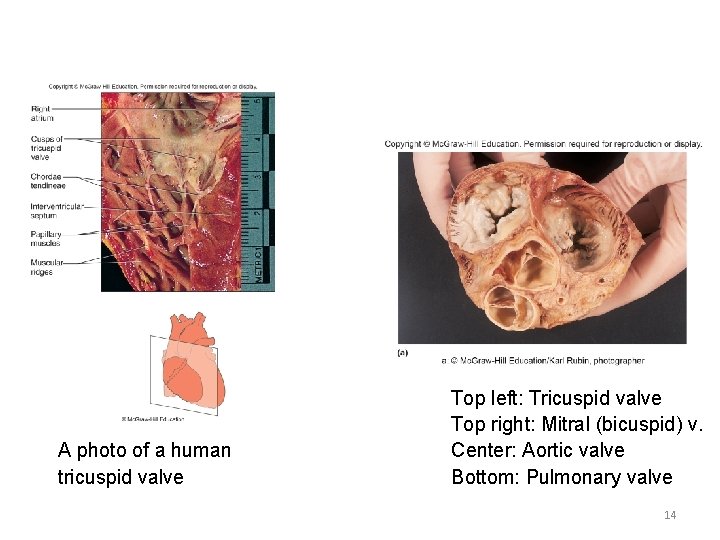 A photo of a human tricuspid valve Top left: Tricuspid valve Top right: Mitral