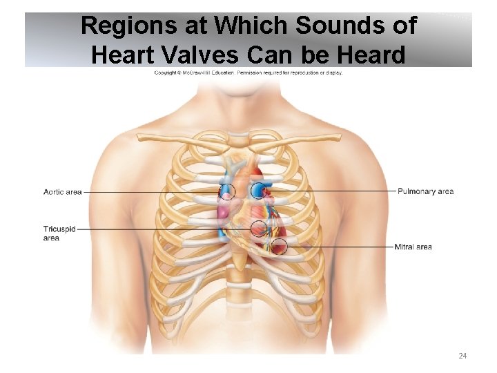 Regions at Which Sounds of Heart Valves Can be Heard 24 