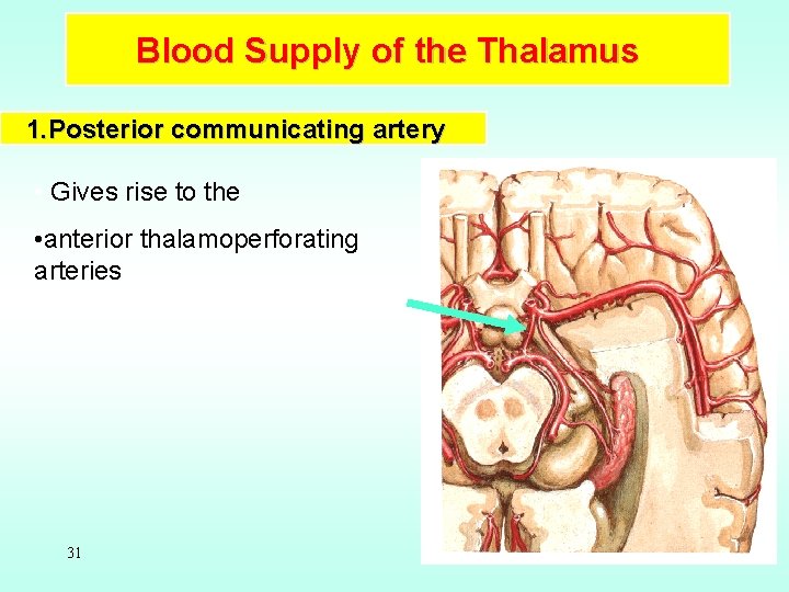 Blood Supply of the Thalamus 1. Posterior communicating artery • Gives rise to the