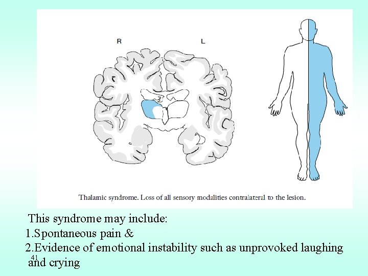 This syndrome may include: 1. Spontaneous pain & 2. Evidence of emotional instability such
