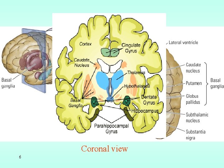 Coronal view 6 