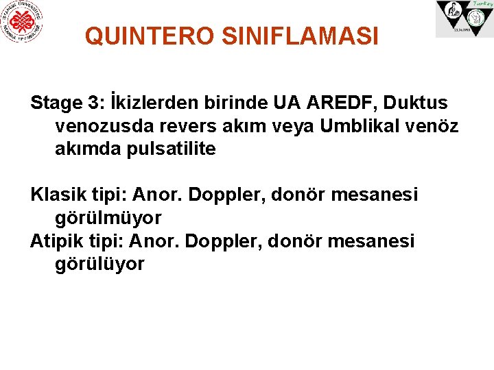 QUINTERO SINIFLAMASI Stage 3: İkizlerden birinde UA AREDF, Duktus venozusda revers akım veya Umblikal