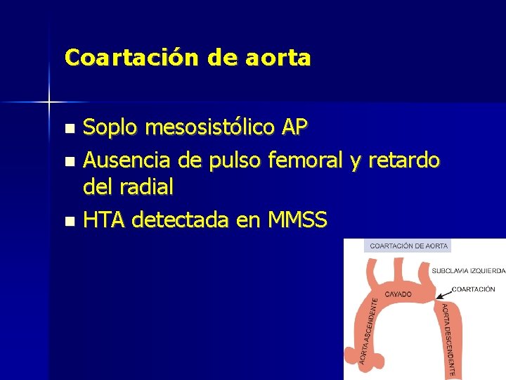 Coartación de aorta Soplo mesosistólico AP Ausencia de pulso femoral y retardo del radial