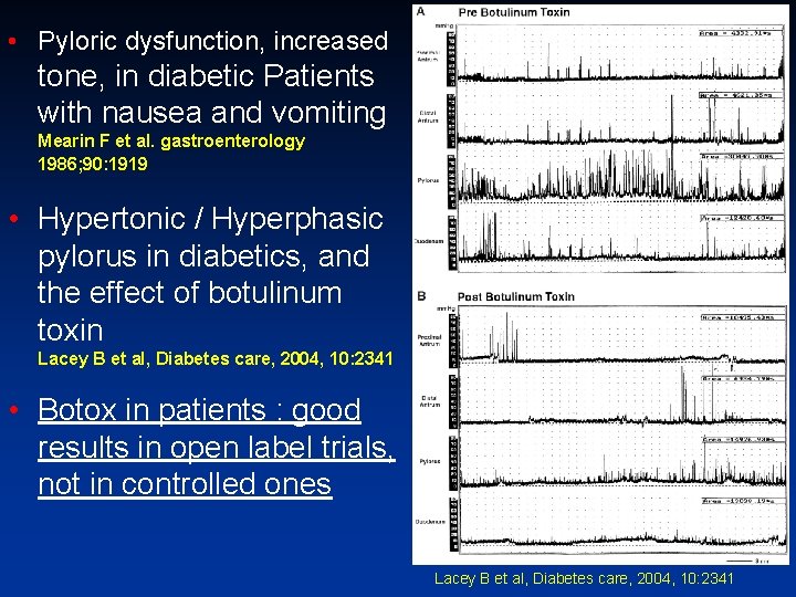  • Pyloric dysfunction, increased tone, in diabetic Patients with nausea and vomiting Mearin