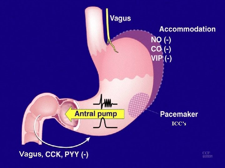 ICC’s Vagus, 