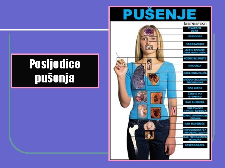 Posljedice pušenja 