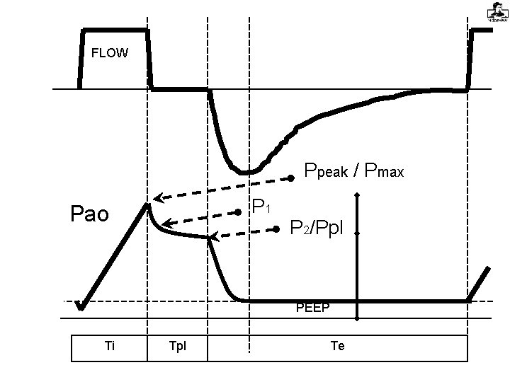 FLOW Ppeak / Pmax P 1 Pao P 2/Ppl PEEP Ti Tpl Te 