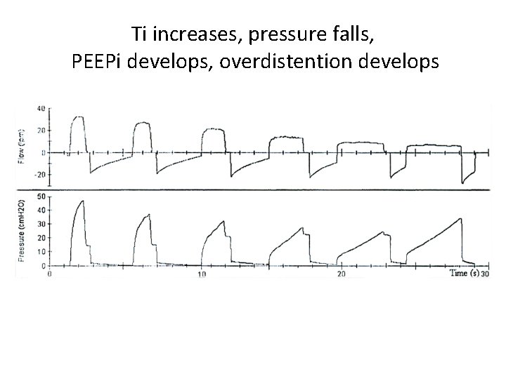Ti increases, pressure falls, PEEPi develops, overdistention develops 